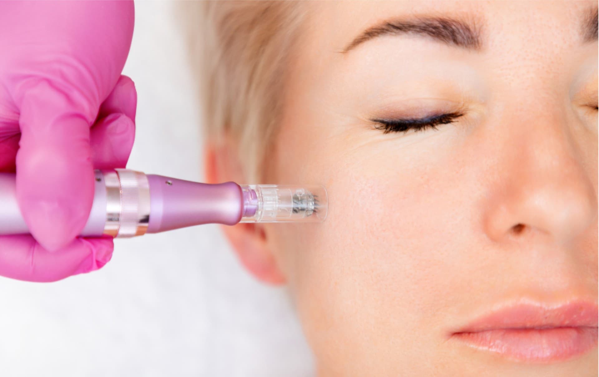 skin treatments