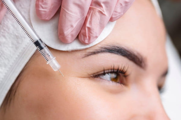 botox filler